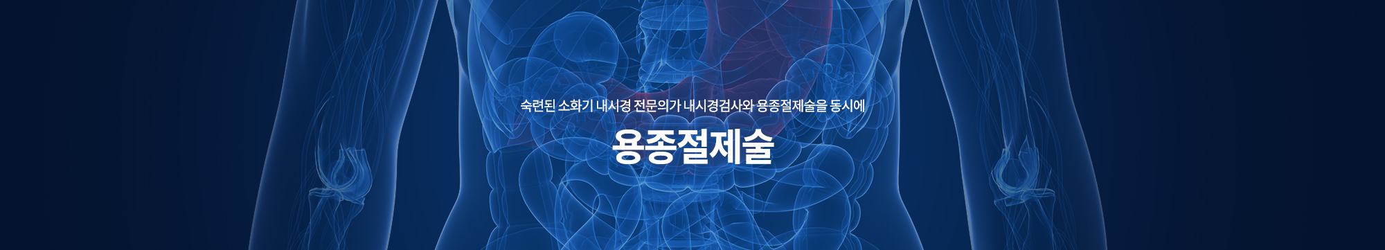 숙련된 소화기 내시경 전문의가 내시경검사와 용종절제술을 동시에 용종절제술