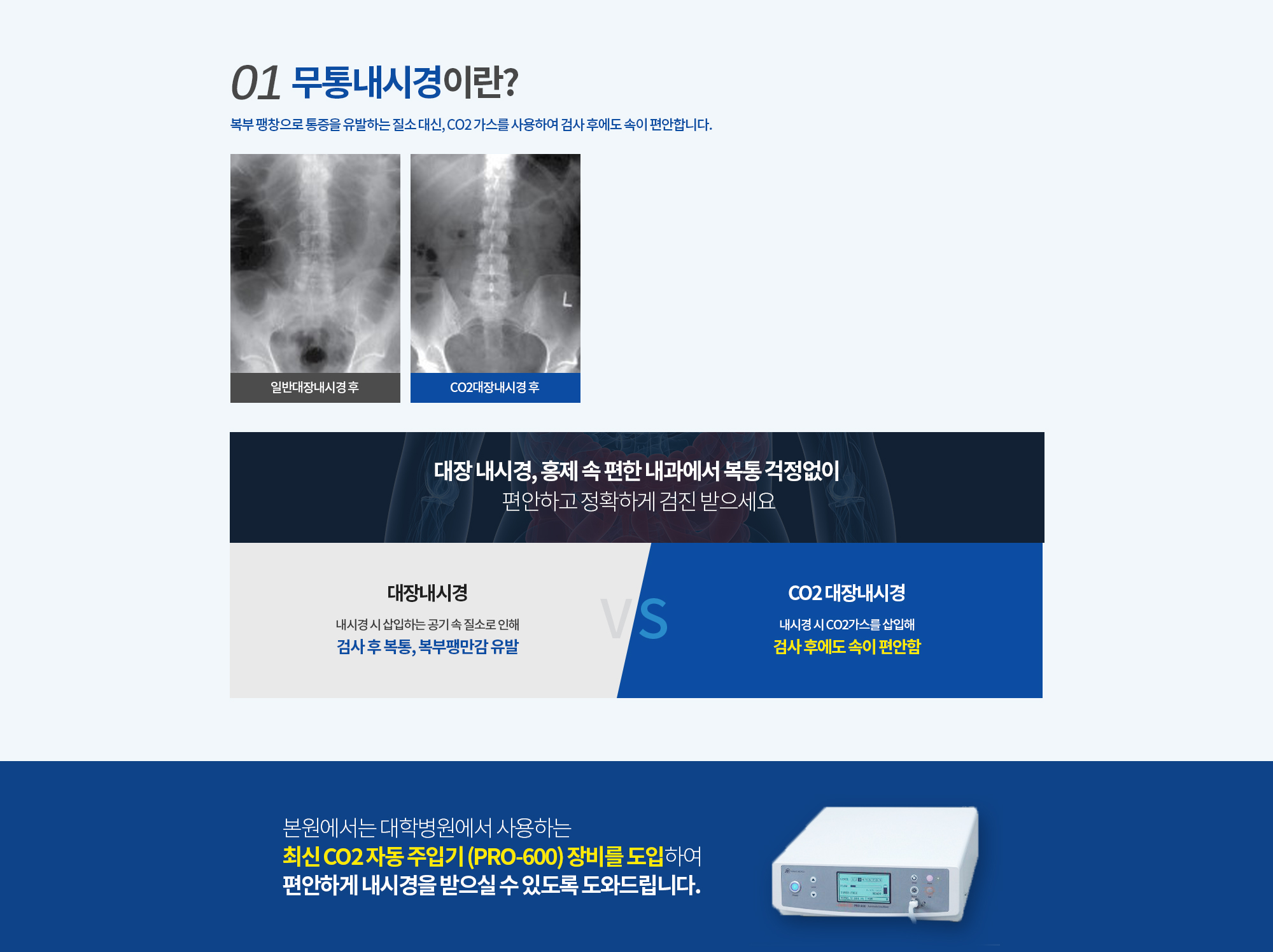 01. 무통내시경이란? 
		복부 팽창으로 통증을 유발하는 질소 대신,
		CO2 가스를 사용하여 검사 후에도 속이 편안합니다. 
		삽입된 CO2 가스는 검사 후 30분 ~ 1시간 이내에 빠르게 장 내벽으로 흡수되어 호흡을 통해 밖으로 배출됩니다. 몸에는 전혀 해가 없으며, 일반 내시경과 달리 내시경 후에도 생길 수 있는 복통, 복부팽만감, 천공 등의 부작용을 최소화합니다. 

		대장 내시경, 홍제 속 편한 내과에서 복통 걱정없이 편안하고 정확하게 검진 받으세요
		일반 대장내시경
		내시경 시 삽입하는 공기 속 질소로 인해 검사 후 복통, 복부팽만감 유발

		CO2 대장내시경
		내시경 시 CO2가스를 삽입해 검사 후에도 속이 편안함

		본원에서는 대학병원에서 사용하는 
		최신 CO2 자동 주입기 (VS-200C) 장비를 도입하여 
		편안하게 내시경을 받으실 수 있도록 도와드립니다.